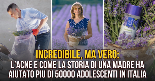 L'ACNE e come la storia di una madre ha aiutato più di 50.000 adolescenti in Italia!