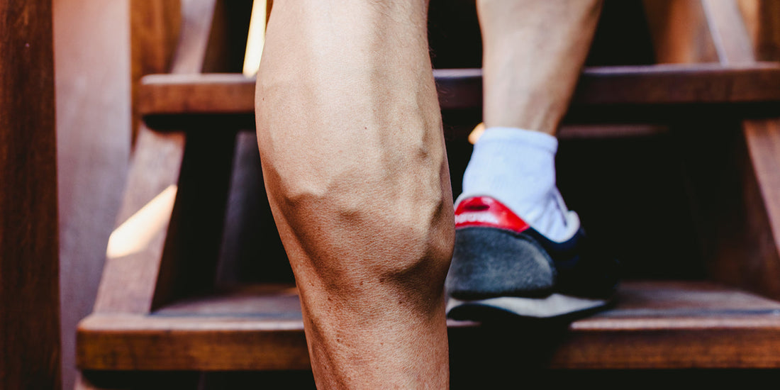 vene varicose e fitness - come prevenirle