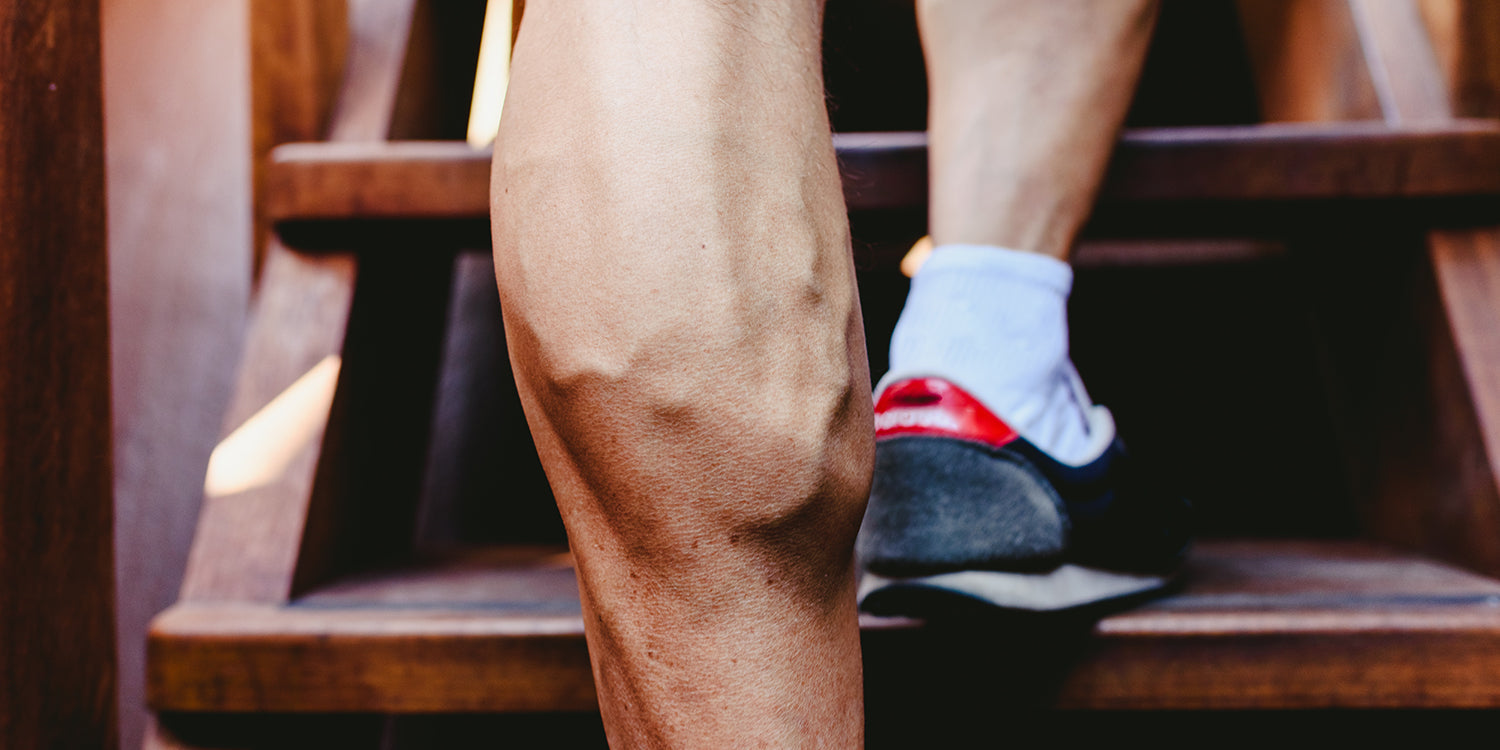 vene varicose e fitness - come prevenirle