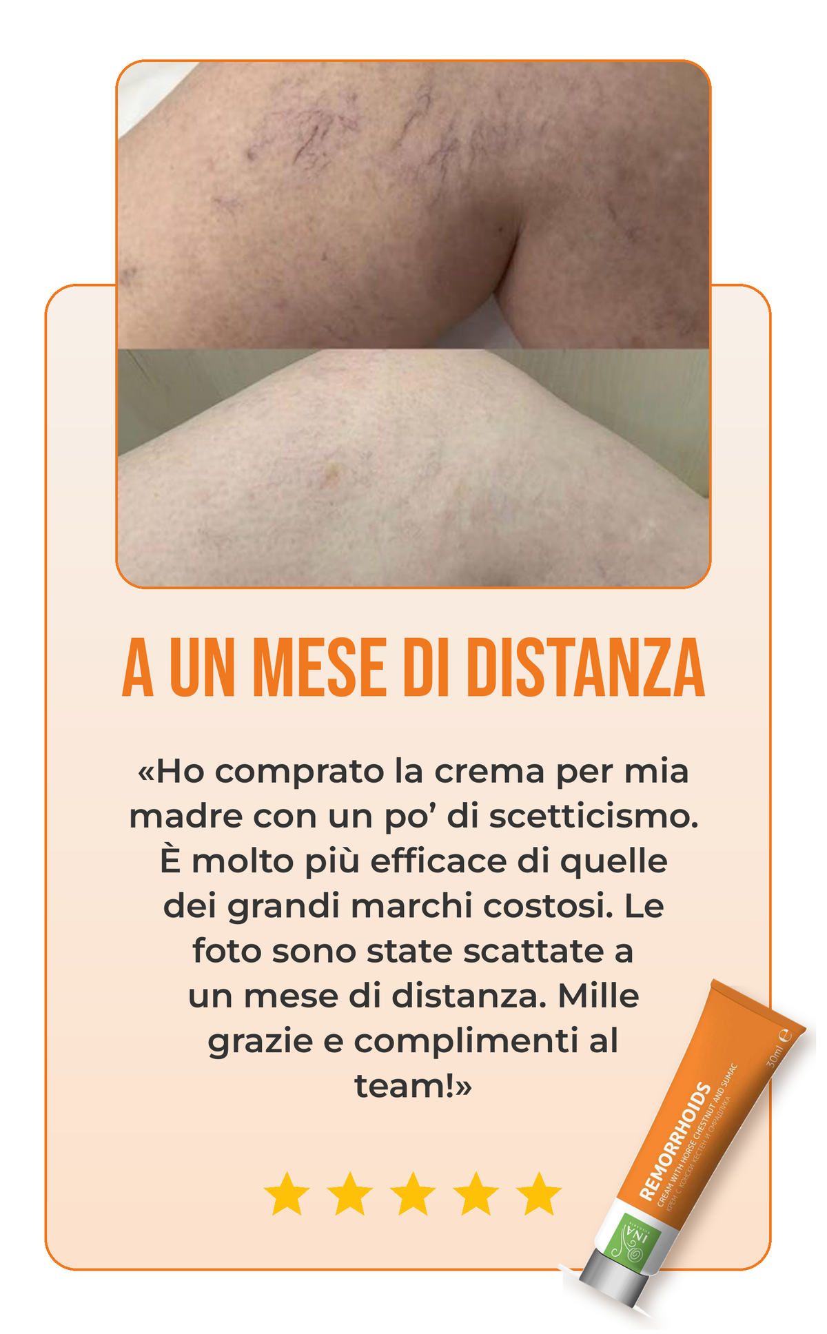 Recensione crema per vene varicose 1