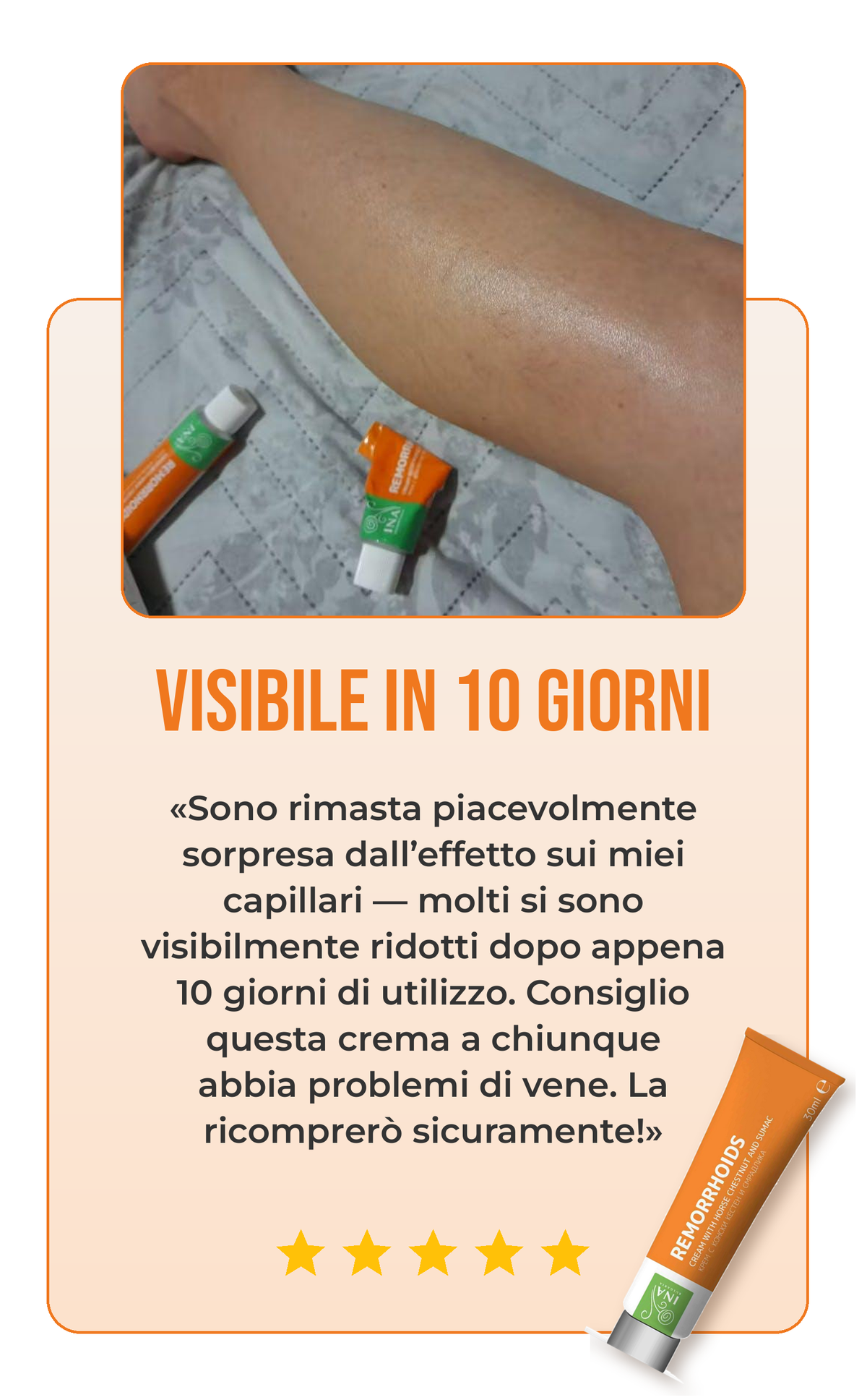Recensione crema per vene varicose 2