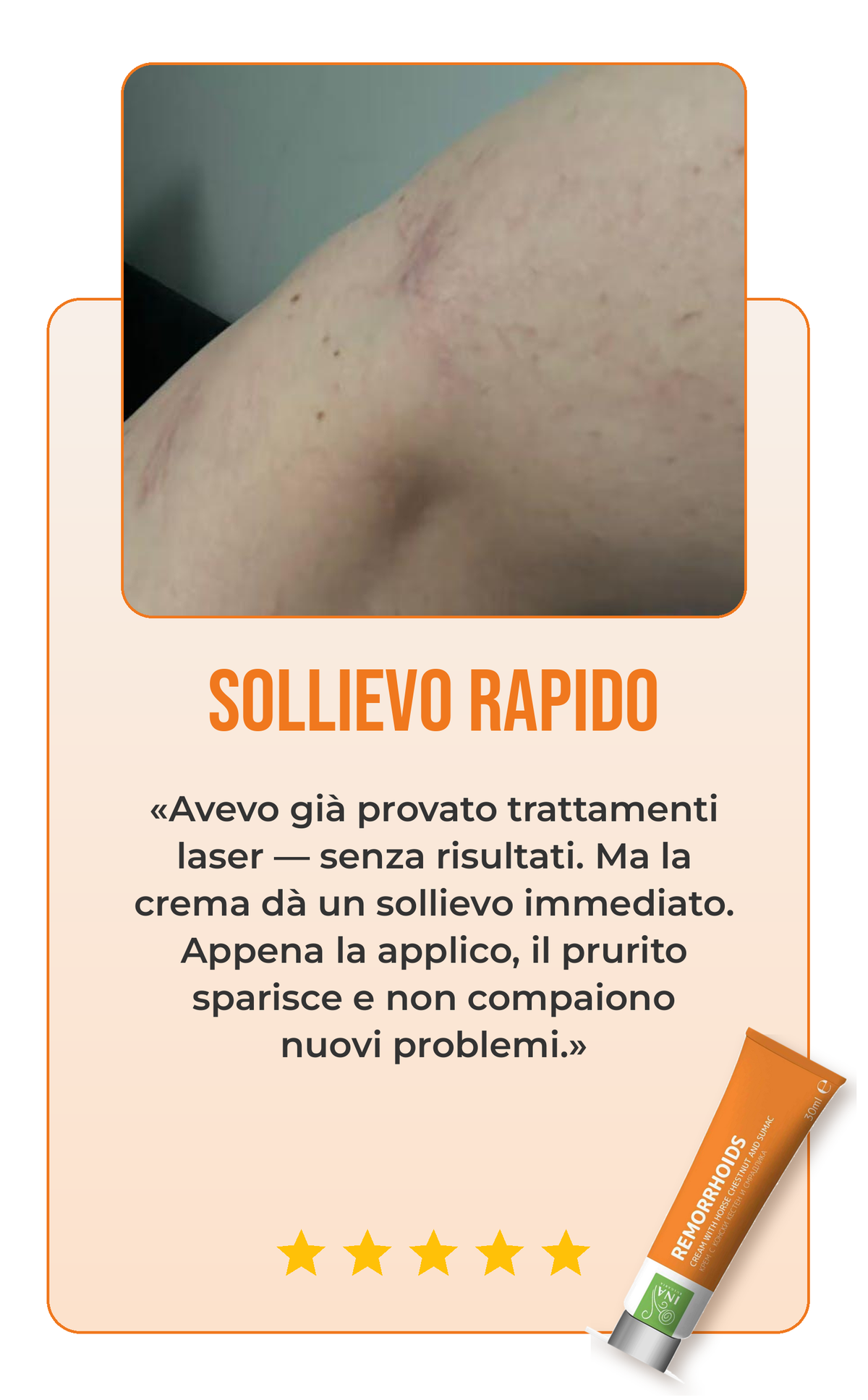 Recensione crema per vene varicose 3