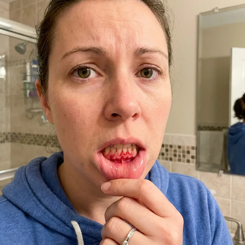 Before - dental treatment