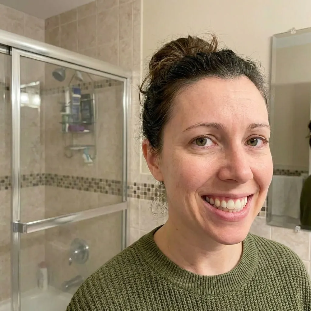 After - dental treatment