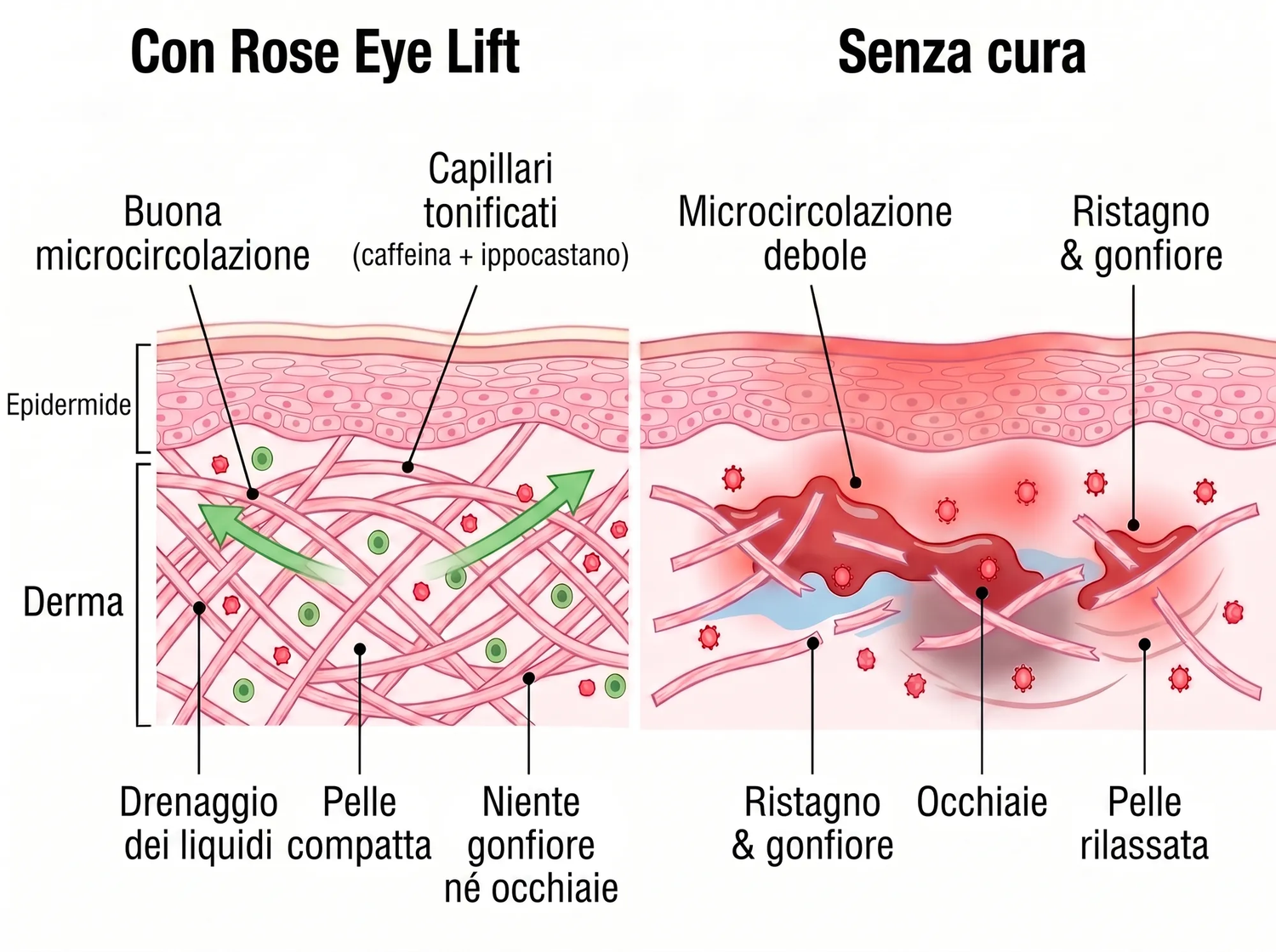 Rose Eye Lift IT t17